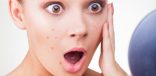 Cystic acne