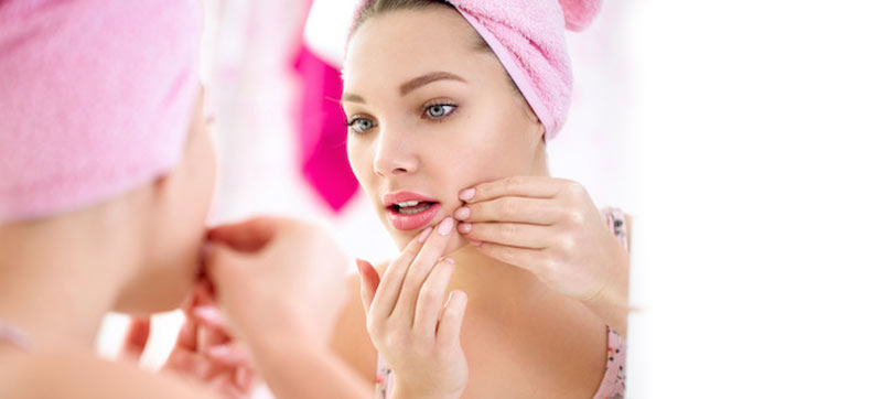 adult acne
