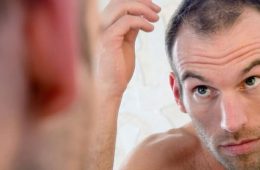 Hair Loss Treatment for Men | Dr Rasya Dixit