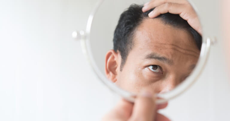 How to Reduce Hair Loss | Dr Rasya Dixit