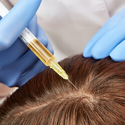 hair loss laser treatment