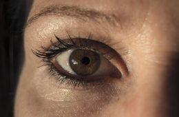 Dark Circles around Eyes