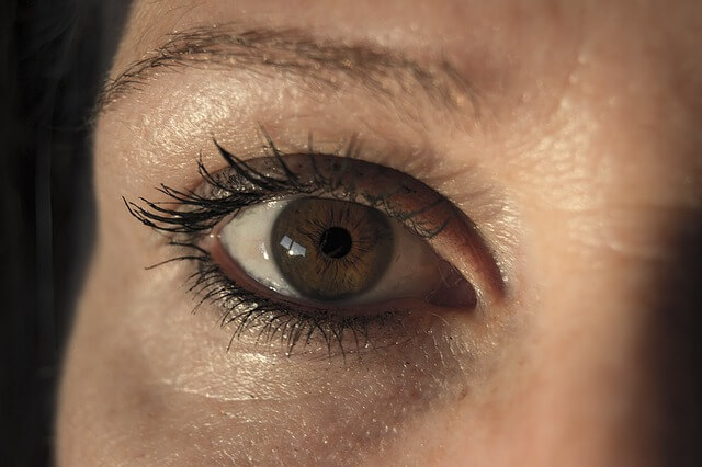 download dark circles around eyes download dark circles around eyes