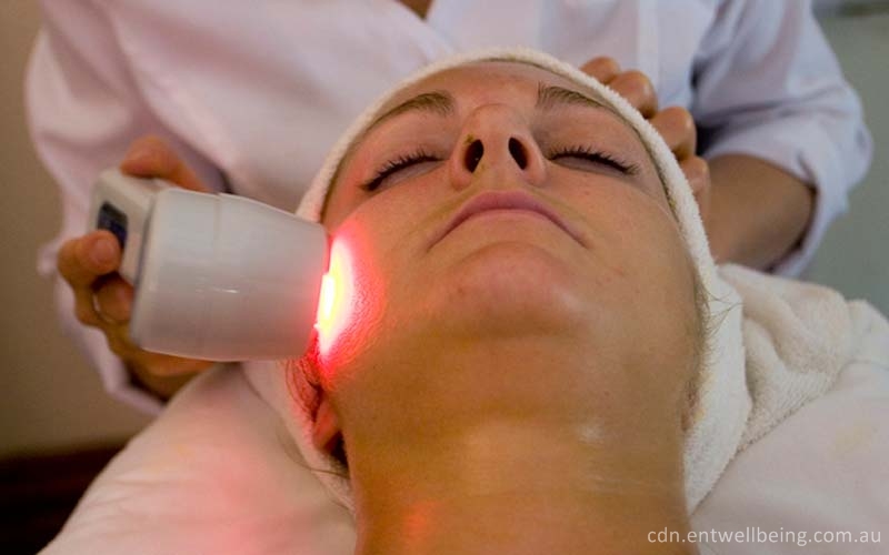 laser hair removal in banglaore