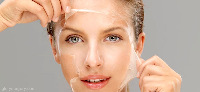 skin peeling treatment