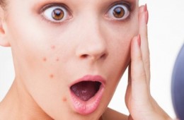 Cystic acne