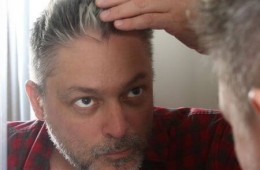 Stress causing hair greying