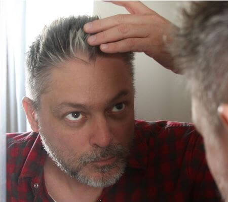 Stress causing hair greying