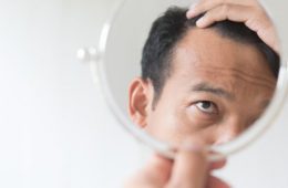 How to Reduce Hair Loss | Dr Rasya Dixit