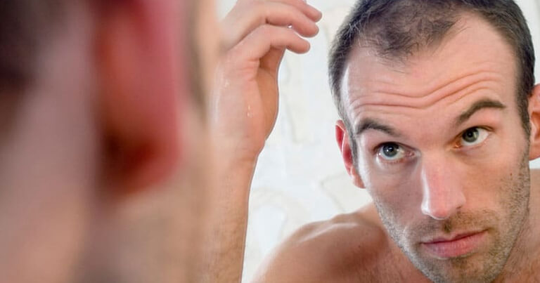 Hair Loss Treatment for Men | Dr Rasya Dixit