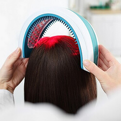 hair loss laser treatment