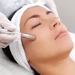 Microdermabrasion